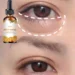 Top Moisturizing Eye Oil to Reduce Puffiness and Brighten Dark Circles Naturally